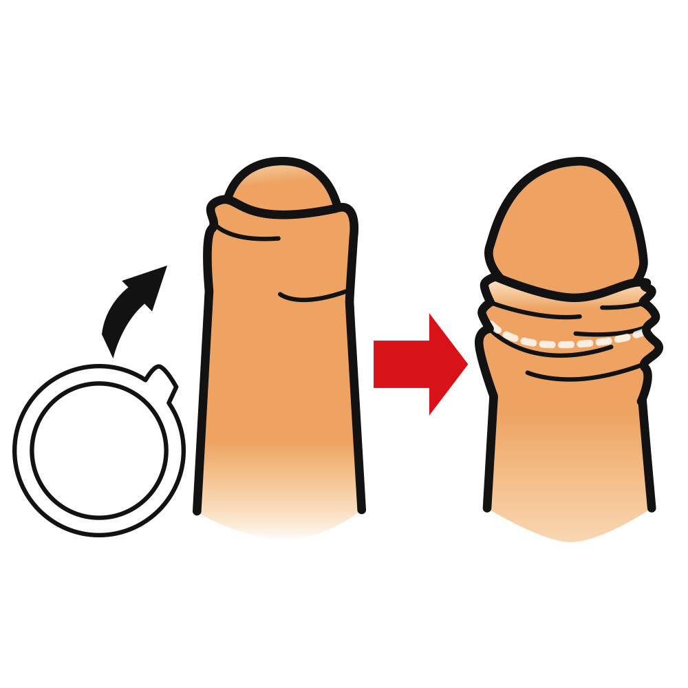 バレずに剥いちゃいましたの画像 2